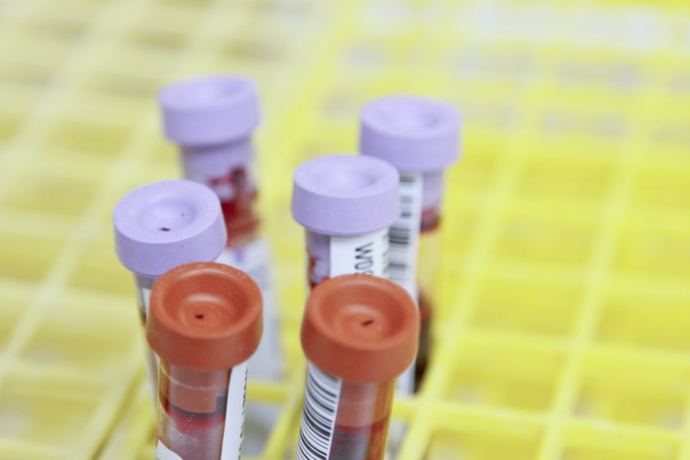 Tubos de laboratorio para análisis de sangre — imagen abstracta